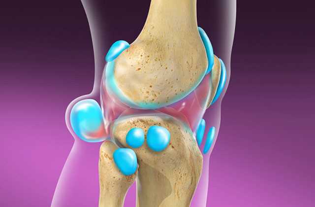 Эффективное лечение разрыва кисты Бейкера коленного сустава