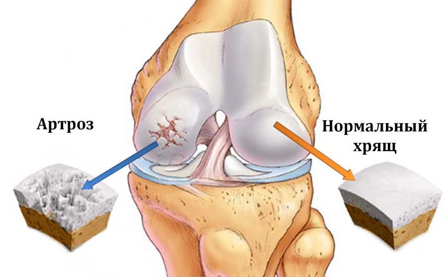 Основные принципы лечения коленного сустава