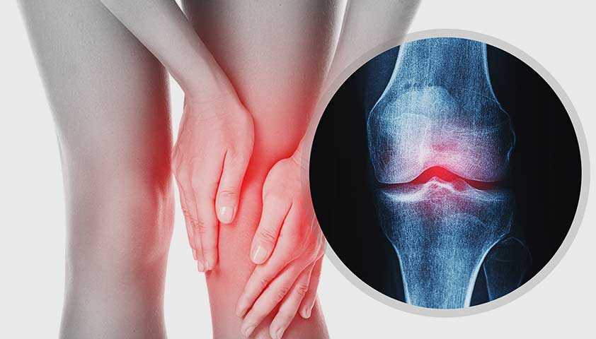 Лечение болезни коленного сустава Шляттера: эффективные методы и рекомендации