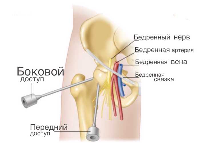 Лечение коленных суставов новокаиновыми инъекциями: как это работает, что нужно знать, результаты