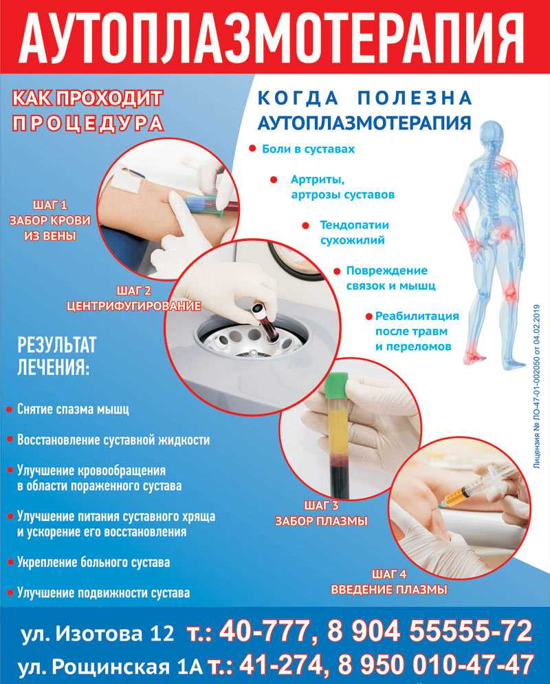 Лечение коленных суставов плазмой крови