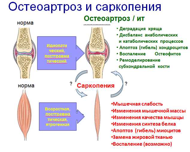 Раздел 2: Традиционные методы лечения остеосклероза коленного сустава
