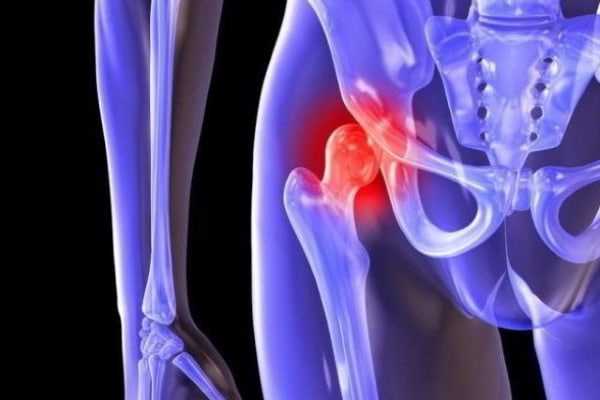 Применение препаратов для улучшения состояния коленного сустава