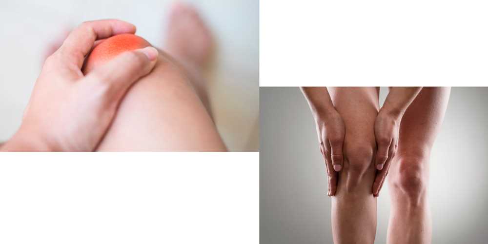 Лечение моноартрита коленного сустава