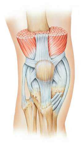 Лечение пателлофеморального артроза коленного сустава 2 степени