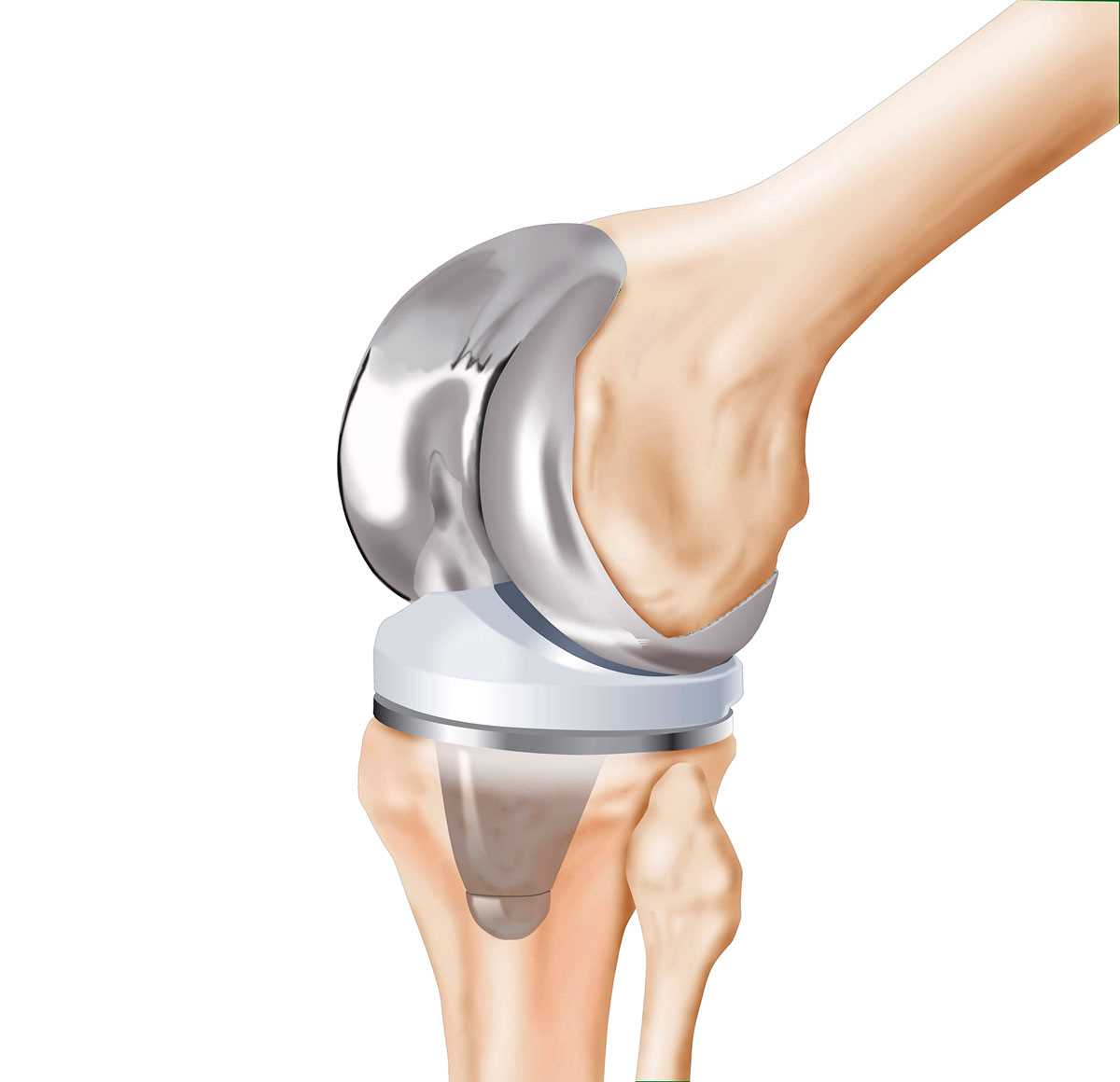 Современное лечение коленного сустава в Рязани