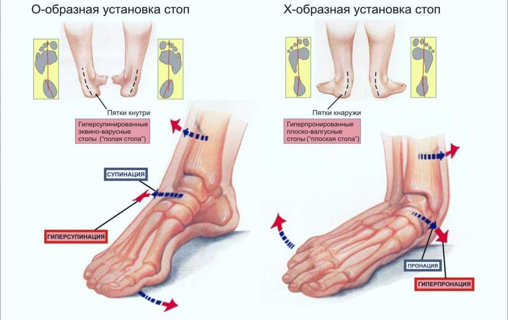 Воспаление надкостницы коленного сустава — симптомы и лечение