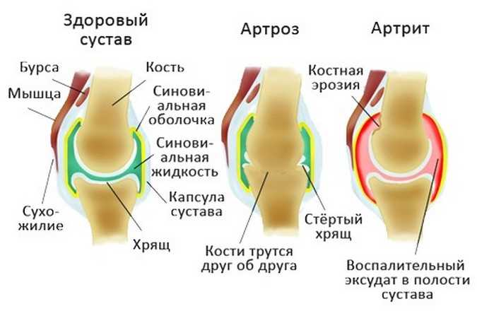 Клиники, предоставляющие услуги по лечению артроза коленного сустава в СПб