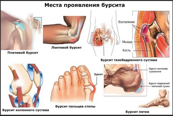 Физиотерапевтические процедуры для восстановления коленного сустава