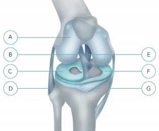 Симптомы и диагностика протрузии мениска коленного сустава