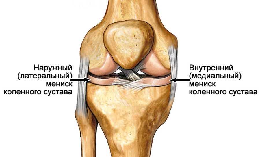 Протрузия мениска коленного сустава - симптомы и методы лечения