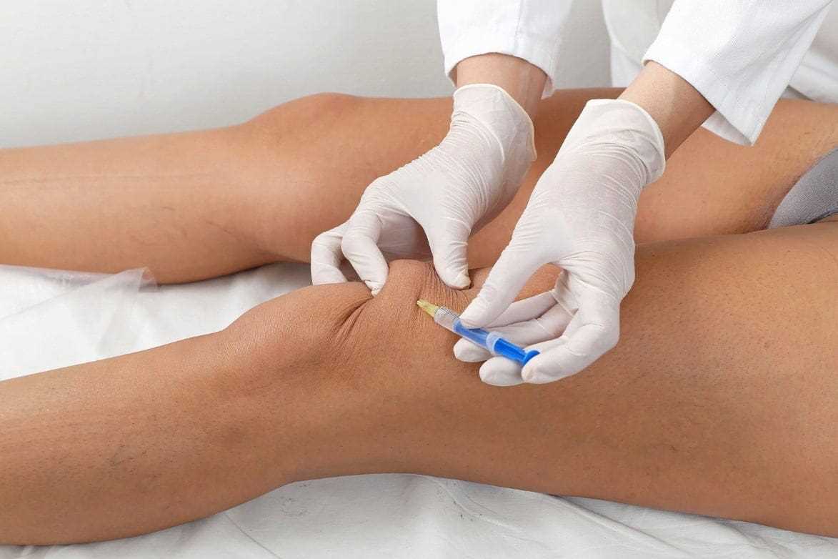 Преимущества лечения артроза коленного сустава уколами гиалуроновой кислоты